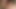 Prostatemilking sperm dripping long before cumshot