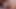 TEASiNG SOLO VIII - MKX