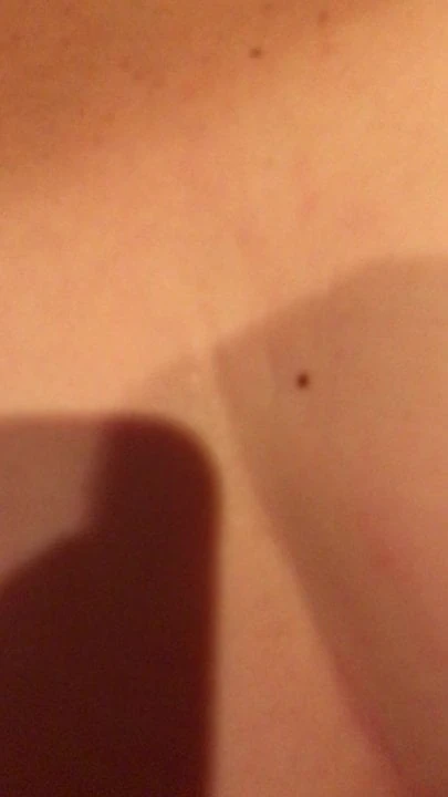 Anal Stute