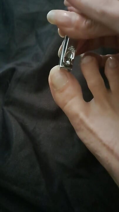 Long Toenail Clipping