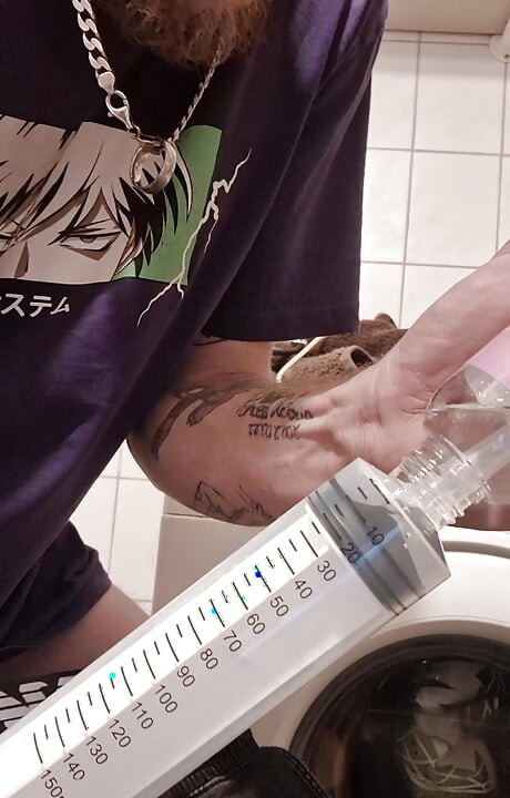 dilatation de mon urètre