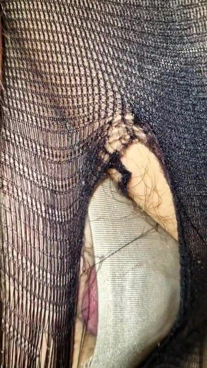Dick