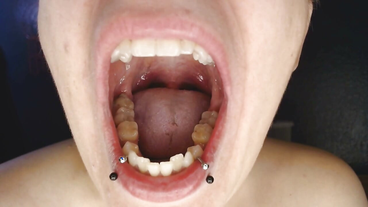 Climb Inside Wide Open Teeth Tongue Mouth Show