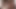 Bbcの毎日の投与量＃04