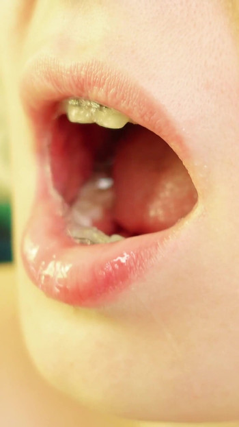Spectacular moment from "braces mouth tour video - vore fetish"