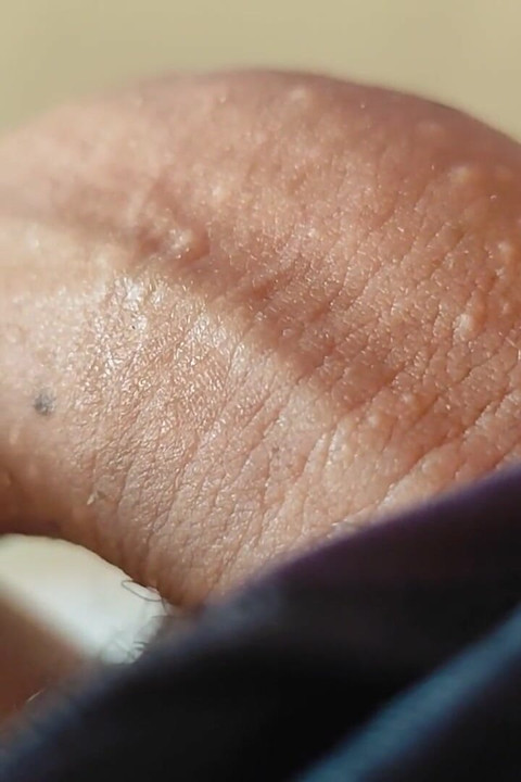 Una Polla Extraña Y Bultosa Con Una Cabeza Gigantesca.