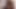 Geiler MILF-Doktor fistet blonde patientin wild