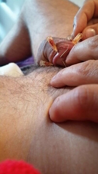 Needles in cock