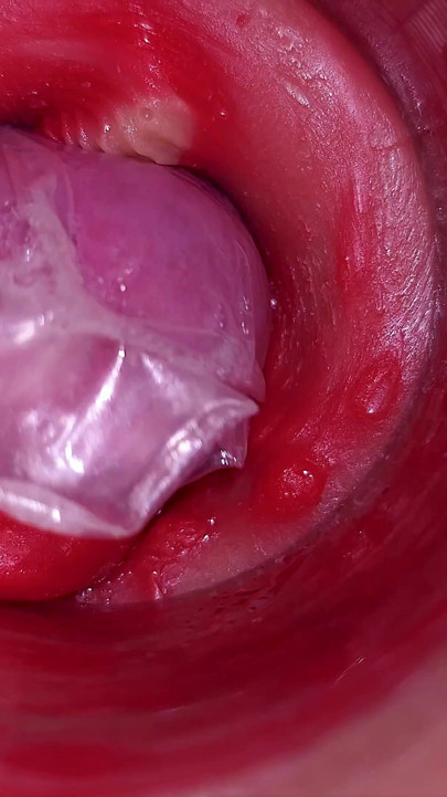The camera inside the deep pussy records a huge ejaculation with a stuck condom! | Clip 1