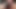 Masturbation extreme an der Eichel mit Nobra Twincharger xxx