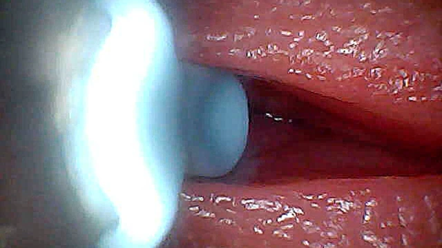 I couldn’t believe what happens INSIDE the penis as sperm passes through (endoscopic footage)