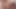Beverly Hills teaser 6