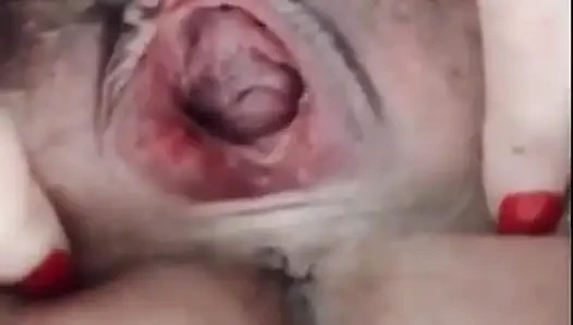 Hairy Pussy Spread Open Gape Upclose
