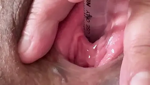 Peehole stretching