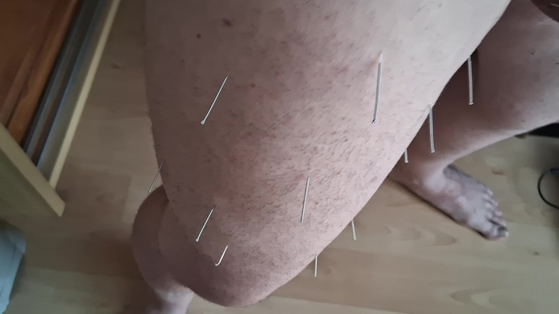 Needles