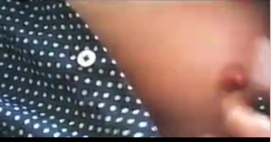 My Nipples