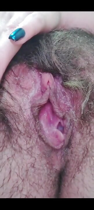 Cận cảnh âm hộ của tôi