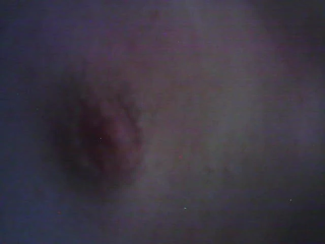 Nippal kore marna