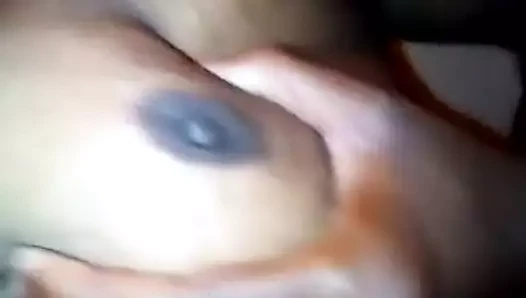 manboobs