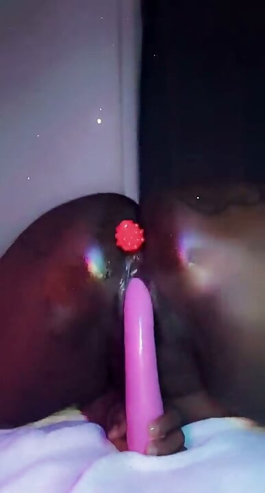 Anal açma
