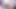 Interracial Anal: 30cm Black Cock in Tight White Ass - Extreme Contrasts