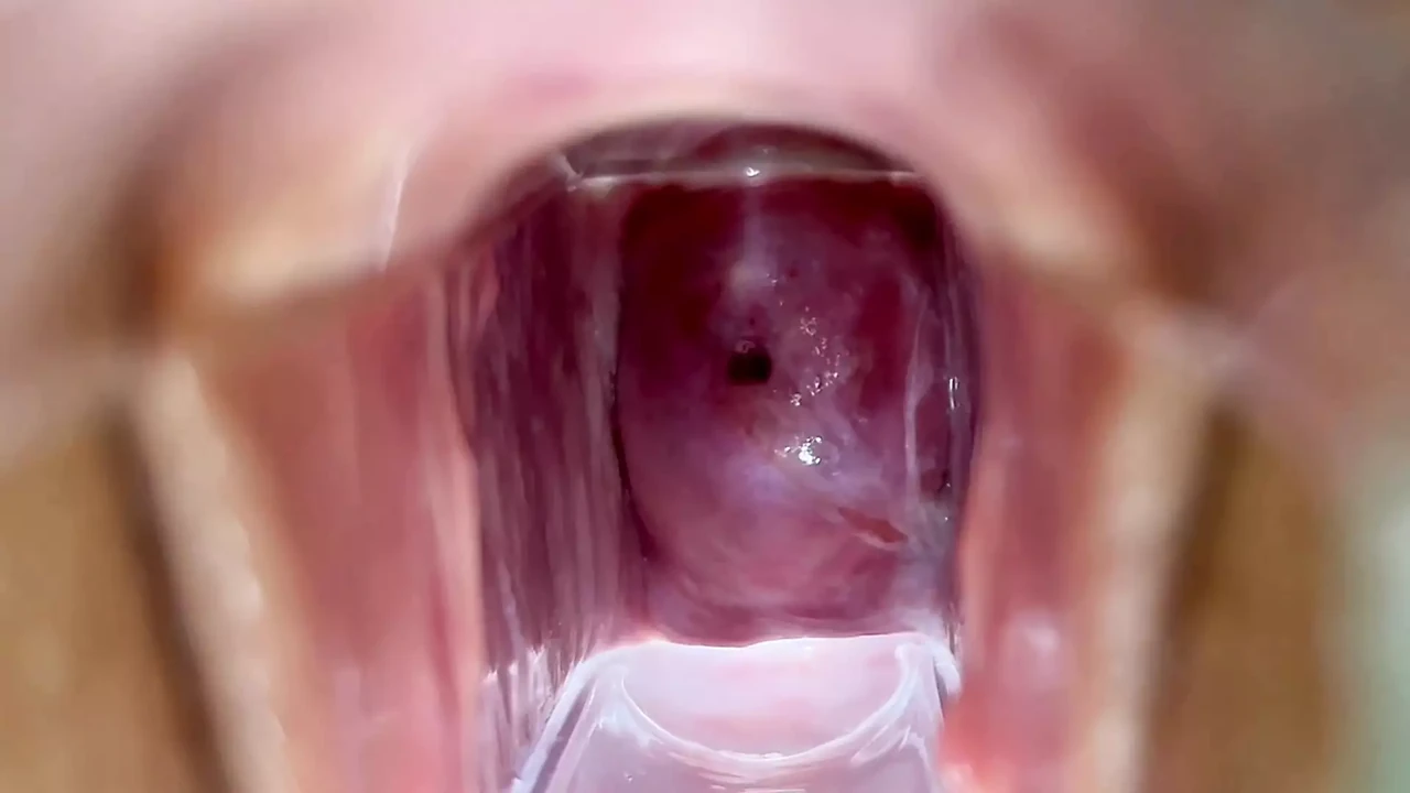Stella St. Rose - Extreme Cervix Views and Juices Flowing Using a Speculum