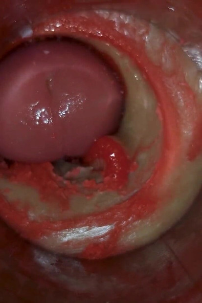 Kamera Unutar Duboke Pičke Snima Ogromnu Ejakulaciju Sperme Asmr
