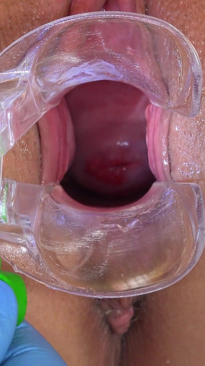 Memorable moment from "Big busty pornstar Jarushka Ross Examined by freaky doctor Tim Wetman and his assistant Kamil Klein"
