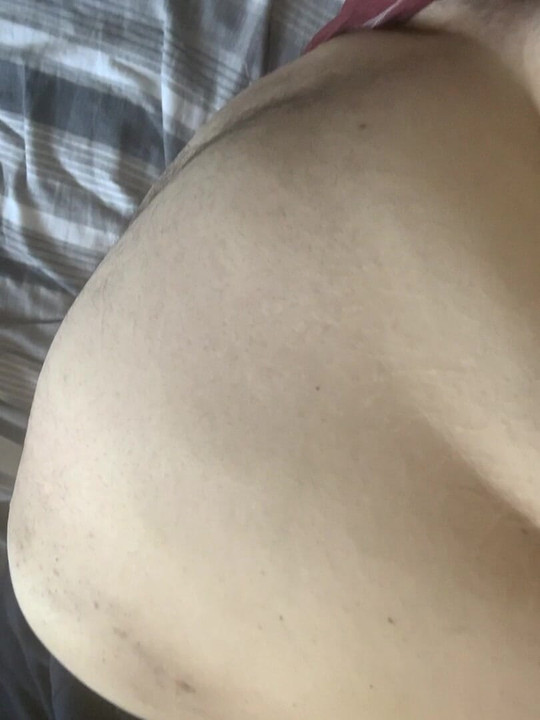 Superchub Belly