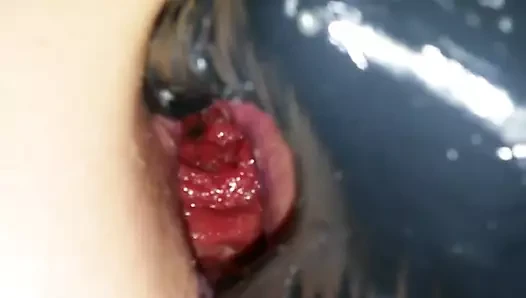 1 Hand Fisting - looking into my AssHole