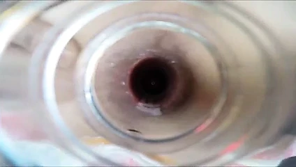 AnalScopee