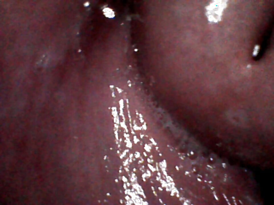 Ini adalah bagian dalam memekku saat aku disetubuhi dengan keras