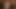 チェリー・トーン・Sアナルデー!