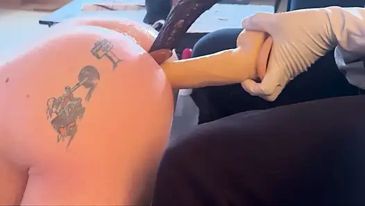 Ağrılı anal esneme