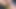 珍しいですが、ボウリングのピンが肛門を壊すのでしょうか?