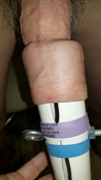 foreskin stretch