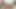 Lizzy Yum SD August 2025 Dilating #73