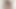 Extreme anal masturbation with prolapse
