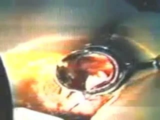 17)Zhangjiajing Nurses Maid Dildo Nurses Taiwan Taiwanese