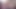 女の子のアナル、足の裏、ぽっ開き、広げられたアソコ