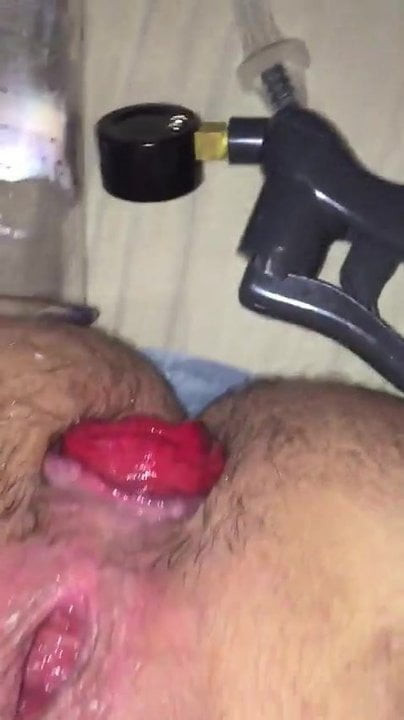 Prolapse