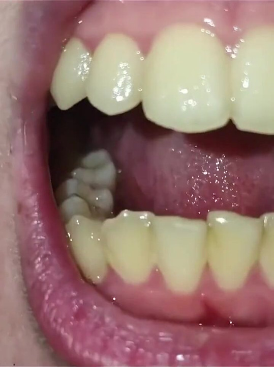 Um close-up da minha garganta