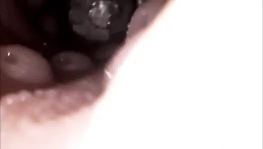 Endoscope Lens Captures Unbearable Pleasure