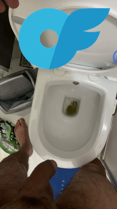 Urine Collection