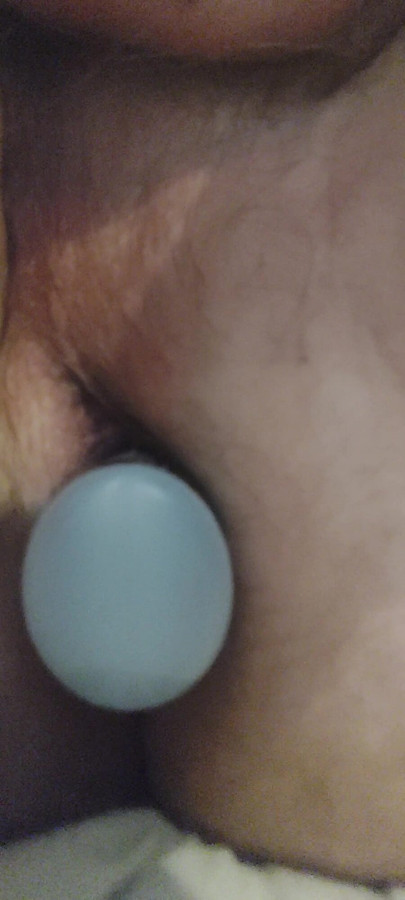 Excitations anal