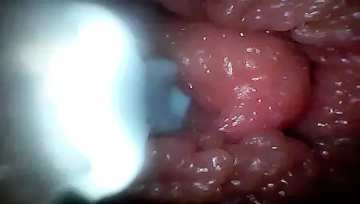 Экстремальная неуядность превращает наблюдателя в активного, голодного участника