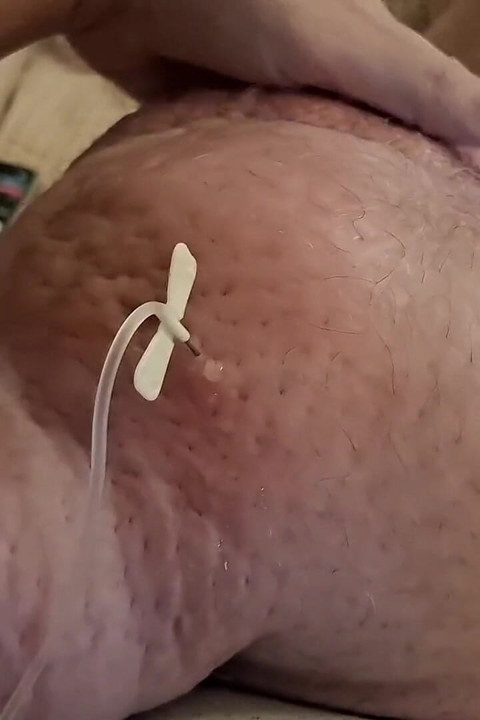 Extreme Fillings Inside My Siliconemeat