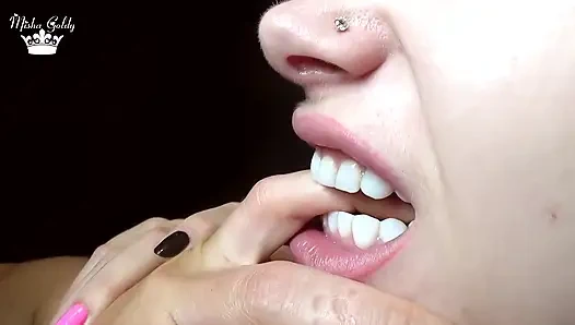 Hard biting of male fingers and arm