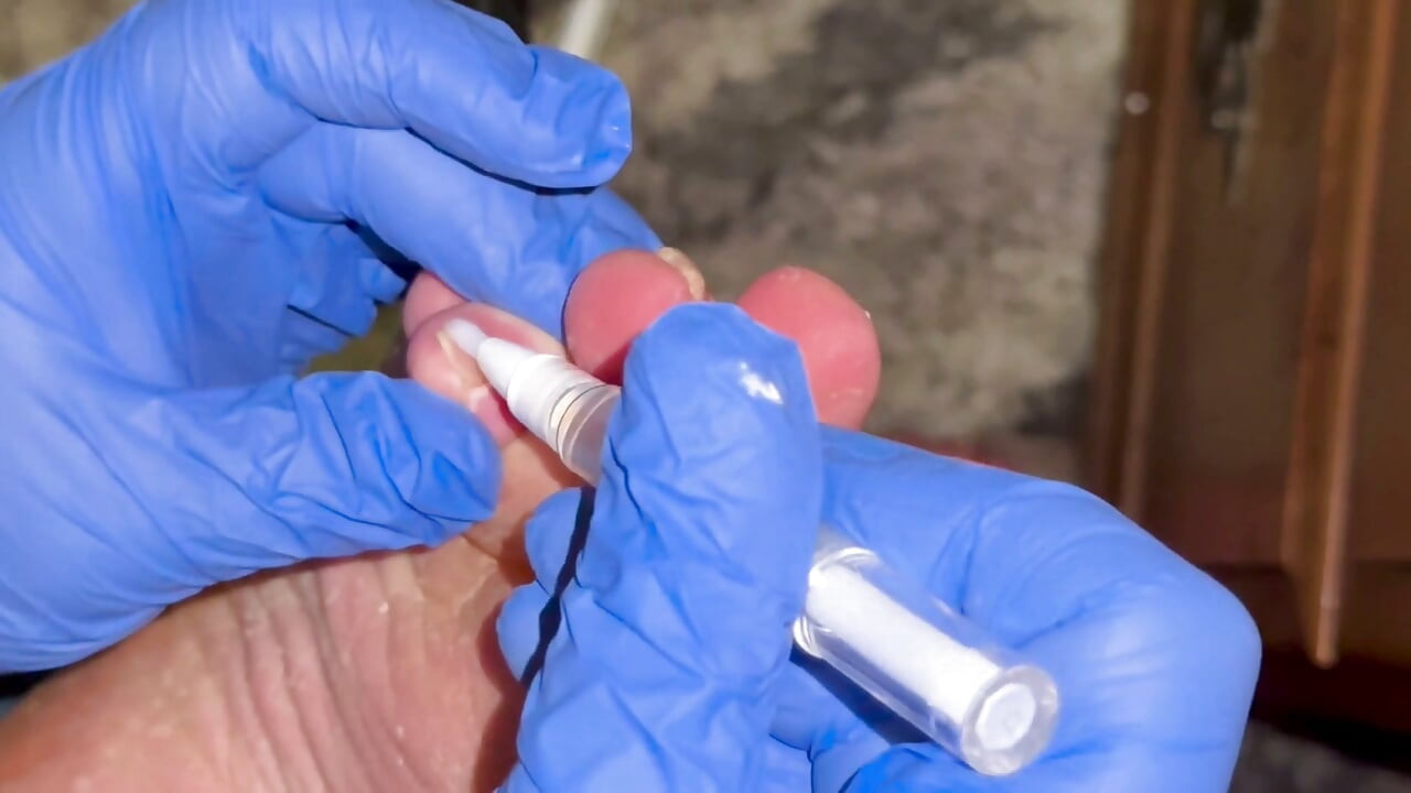 Crusty Foot Care and Worship - FTM