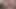Mishelle Klein porn video – Firstanalquest: cute teen Mischelle Klein loves hard anal gape